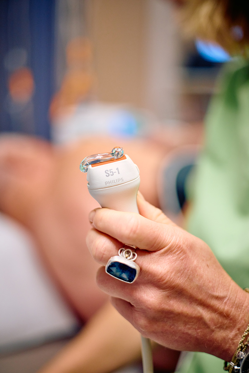 Echocardiographie (ultrason cardiaque) Echocardiographie (ultrason cardiaque)